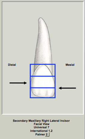 Mx Lateral Facial CofC.png
